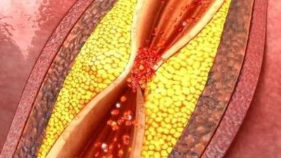 Nicotinamide mononucleotide can dredge blood vessels